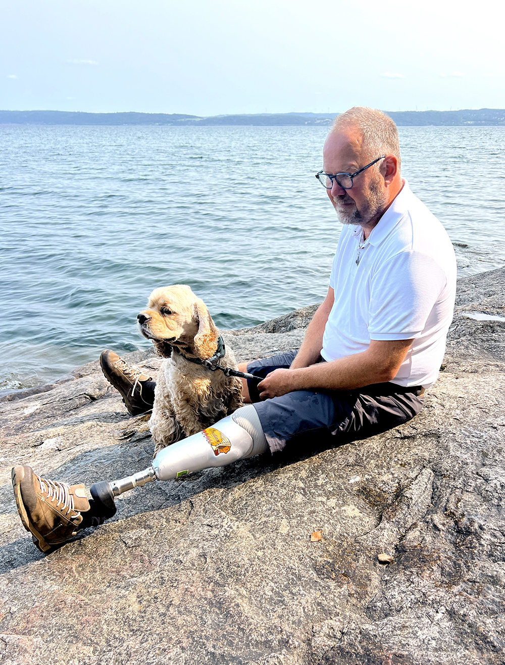 Lower Limb Prosthetics